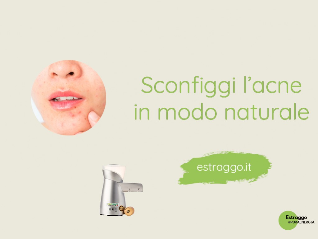 Sei stanca di avere l'acne? Scopri come sconfiggerla in modo naturale! 